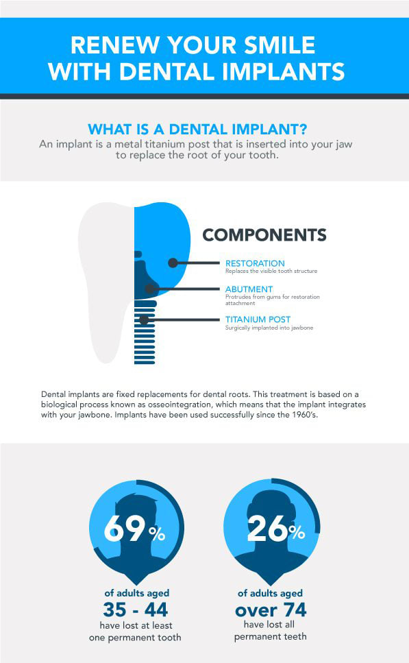 Dental Implants, Sault Ste. Marie
